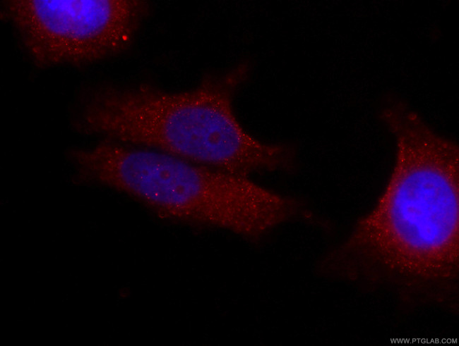 FRS2 Antibody in Immunocytochemistry (ICC/IF)
