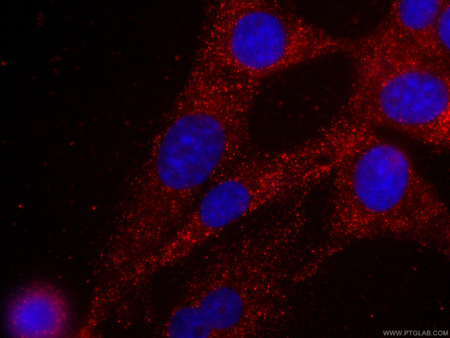 MYL3 Antibody in Immunocytochemistry (ICC/IF)
