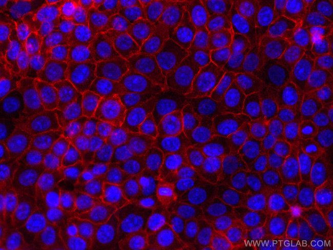 EPCAM Antibody in Immunocytochemistry (ICC/IF)