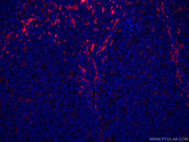 Fascin Antibody in Immunohistochemistry (PFA fixed) (IHC (PFA))