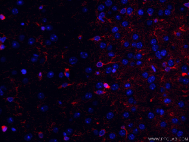 Glutamine synthetase Antibody in Immunohistochemistry (PFA fixed) (IHC (PFA))
