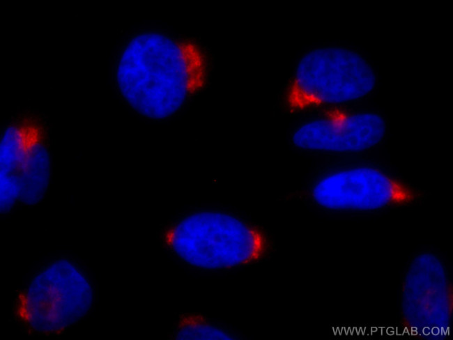 GP73/GOLPH2 Antibody in Immunocytochemistry (ICC/IF)