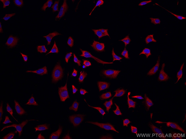 CAPRIN1 Antibody in Immunocytochemistry (ICC/IF)