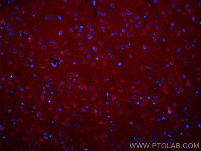 BRE Antibody in Immunohistochemistry (PFA fixed) (IHC (PFA))