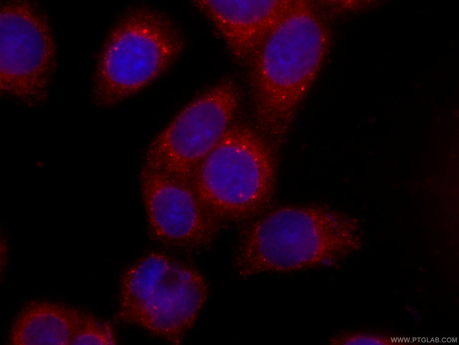 ERp72 Antibody in Immunocytochemistry (ICC/IF)