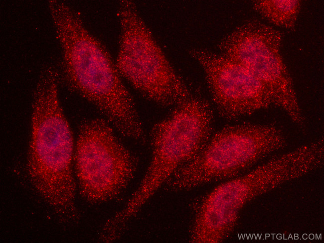 VPRBP Antibody in Immunocytochemistry (ICC/IF)