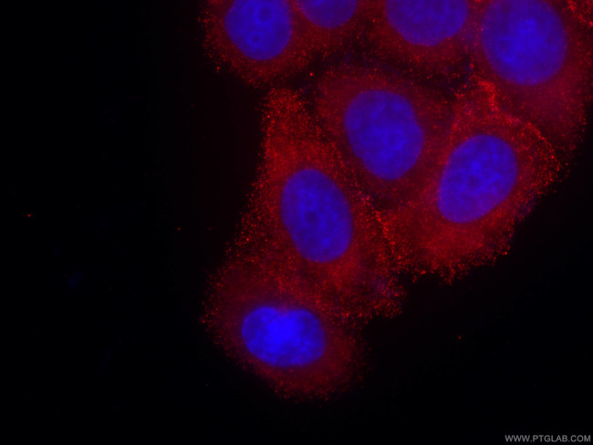 PKC alpha Antibody in Immunocytochemistry (ICC/IF)