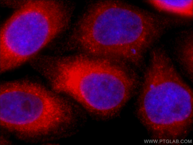 PDI Antibody in Immunocytochemistry (ICC/IF)