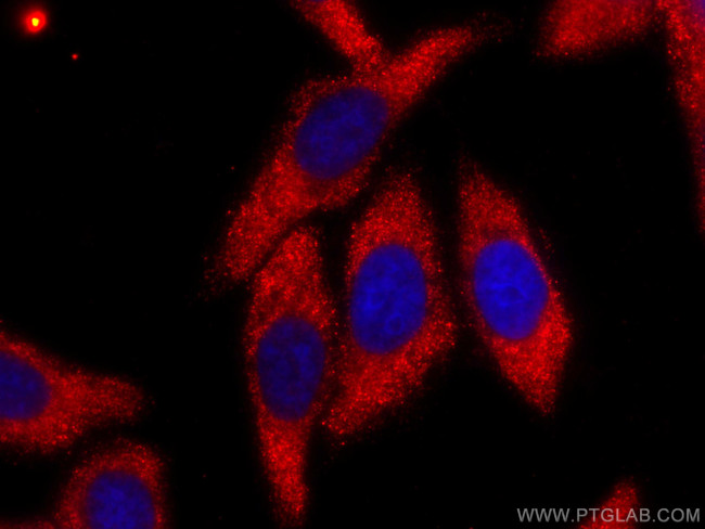 Caspase 3/p17/p19 Antibody in Immunocytochemistry (ICC/IF)