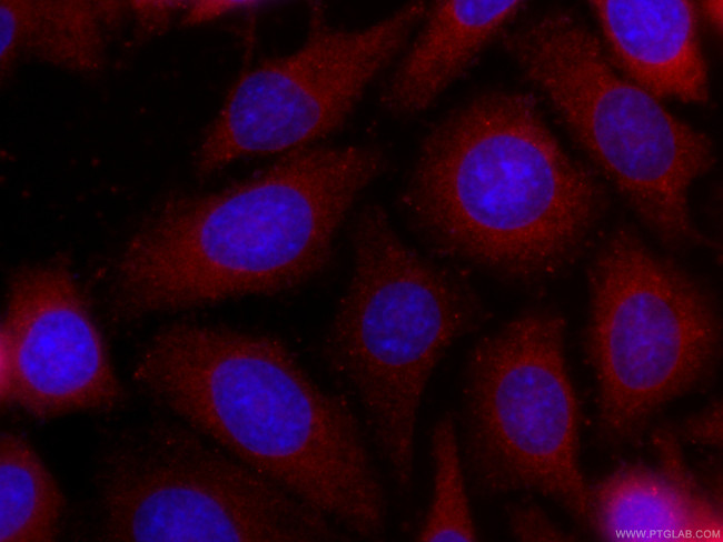 S100A4 Antibody in Immunocytochemistry (ICC/IF)