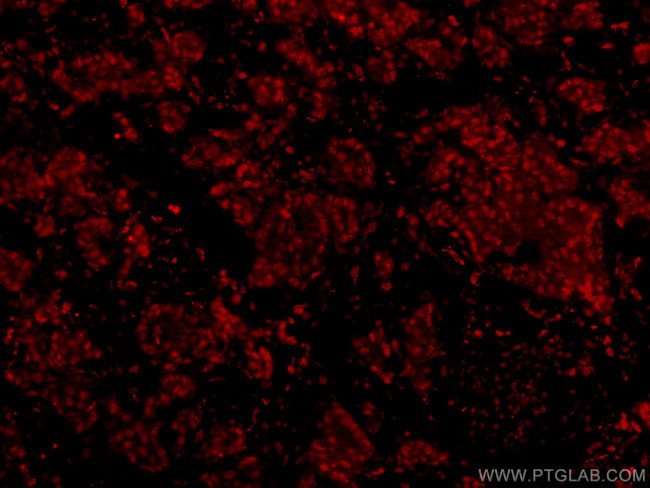 HRPT2; CDC73 Antibody in Immunohistochemistry (PFA fixed) (IHC (PFA))