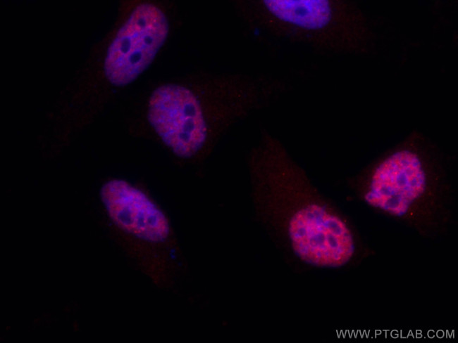 CCAR2 Antibody in Immunocytochemistry (ICC/IF)