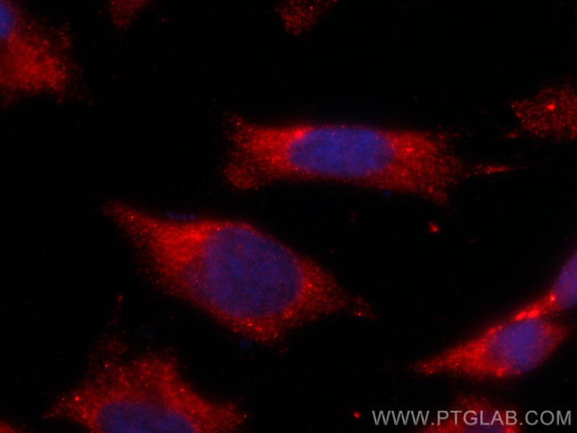 MYPT1 Antibody in Immunocytochemistry (ICC/IF)