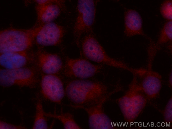 SP1 Antibody in Immunocytochemistry (ICC/IF)