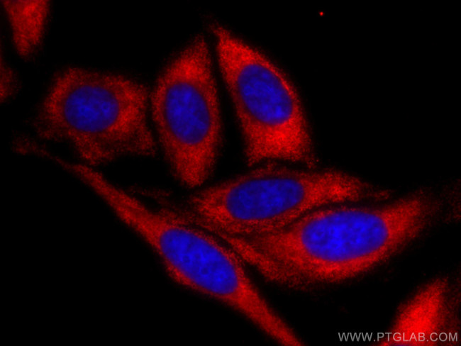 TWIST2 Antibody in Immunocytochemistry (ICC/IF)