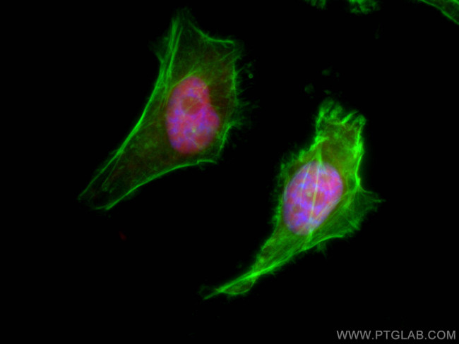 XRCC5 Antibody in Immunocytochemistry (ICC/IF)