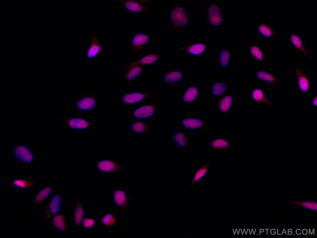 SMARCA4 Antibody in Immunocytochemistry (ICC/IF)
