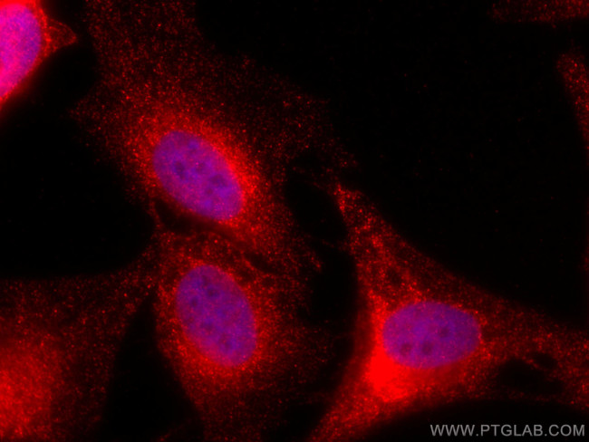 AMPK Beta 2 Antibody in Immunocytochemistry (ICC/IF)
