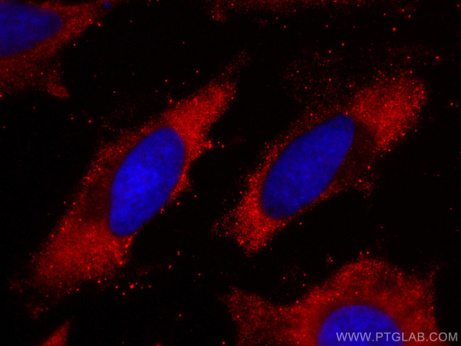 MTHFR Antibody in Immunocytochemistry (ICC/IF)