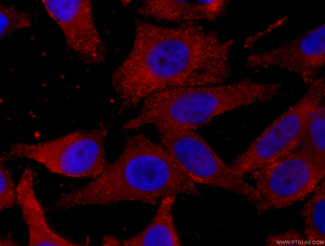 GSTA1 Antibody in Immunocytochemistry (ICC/IF)