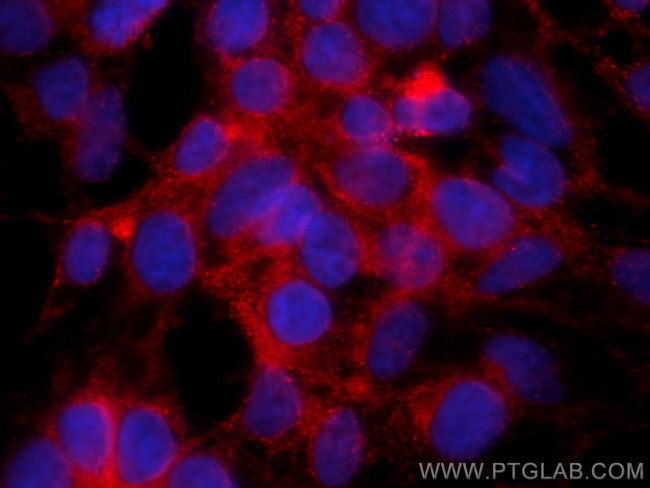 FAF2 Antibody in Immunocytochemistry (ICC/IF)