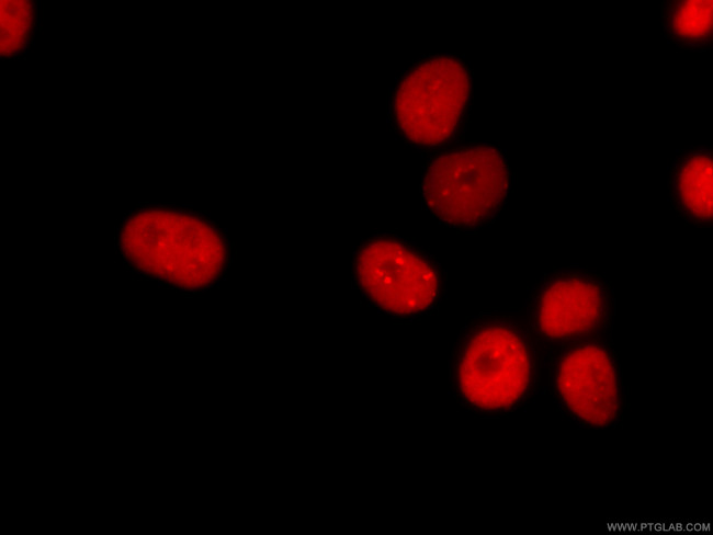 KAP1 Antibody in Immunocytochemistry (ICC/IF)