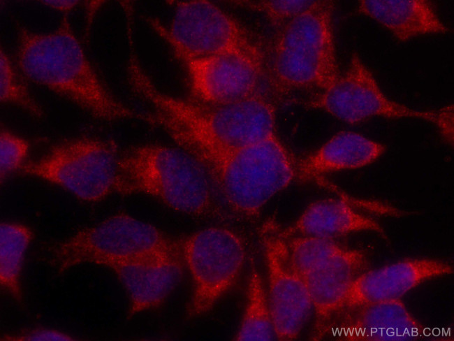 RASGRP3 Antibody in Immunocytochemistry (ICC/IF)
