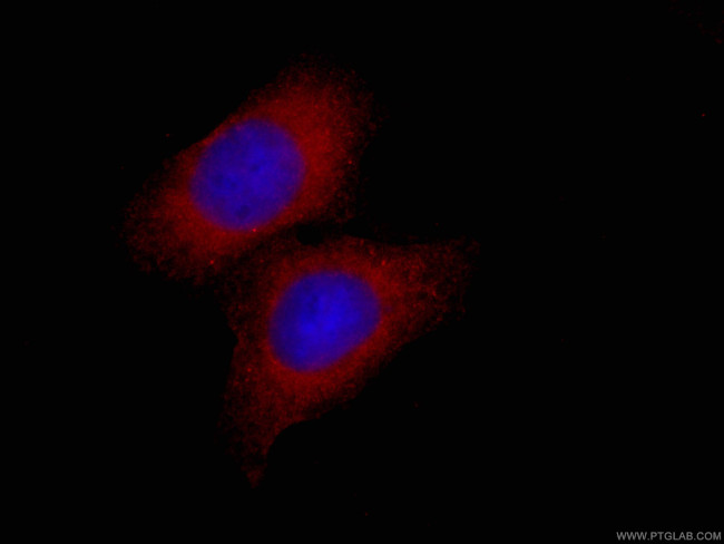 EIF4E Antibody in Immunocytochemistry (ICC/IF)