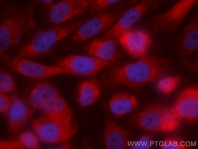 MST1 Antibody in Immunocytochemistry (ICC/IF)