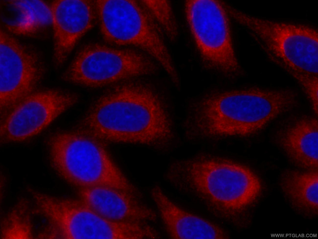 PDIA6 Antibody in Immunocytochemistry (ICC/IF)