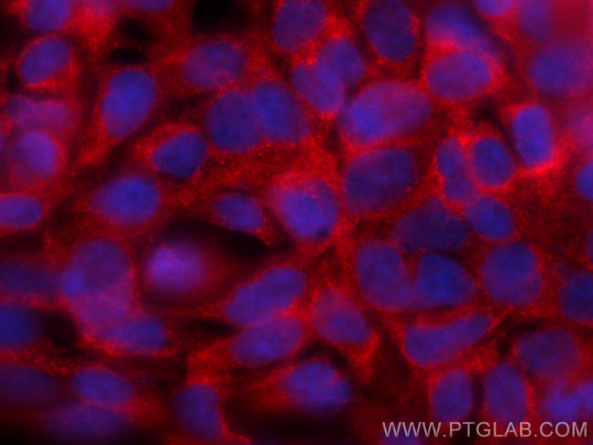 STRAP Antibody in Immunocytochemistry (ICC/IF)