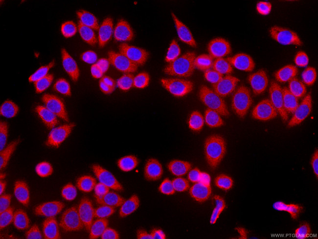 HSPH1 Antibody in Immunocytochemistry (ICC/IF)