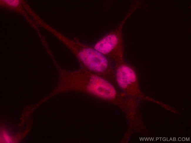 AR Antibody in Immunocytochemistry (ICC/IF)