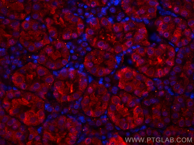 SSTR5 Antibody in Immunohistochemistry (PFA fixed) (IHC (PFA))