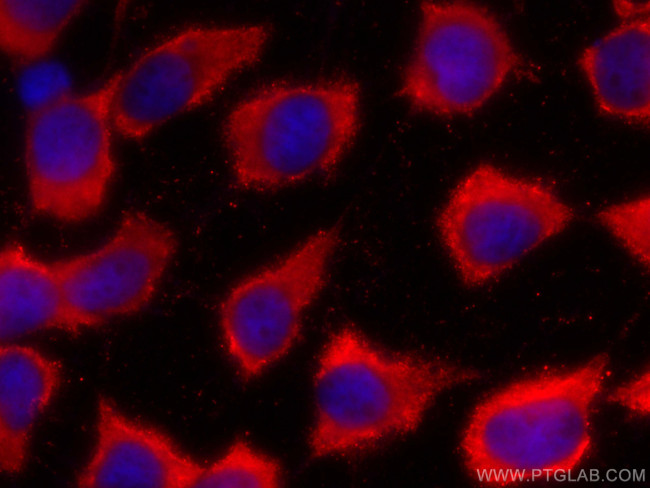 FNTB Antibody in Immunocytochemistry (ICC/IF)