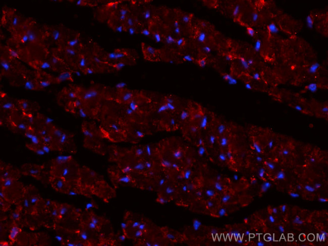 SOCS3 Antibody in Immunohistochemistry (PFA fixed) (IHC (PFA))