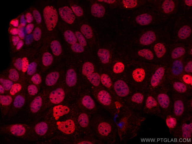 ESRRB Antibody in Immunocytochemistry (ICC/IF)