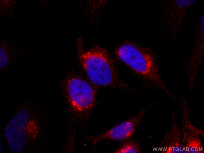 Syntaxin 10 Antibody in Immunocytochemistry (ICC/IF)
