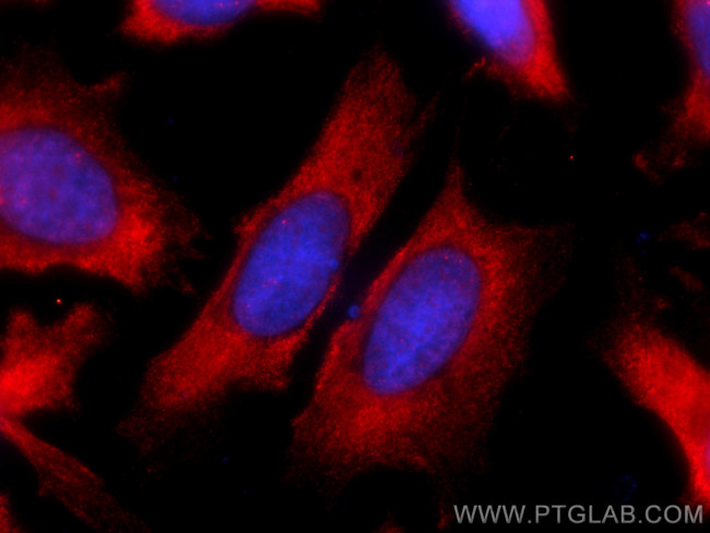 VEGFA Antibody in Immunocytochemistry (ICC/IF)