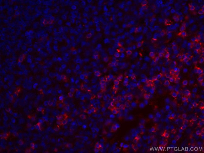 CD8 Antibody in Immunohistochemistry (PFA fixed) (IHC (PFA))