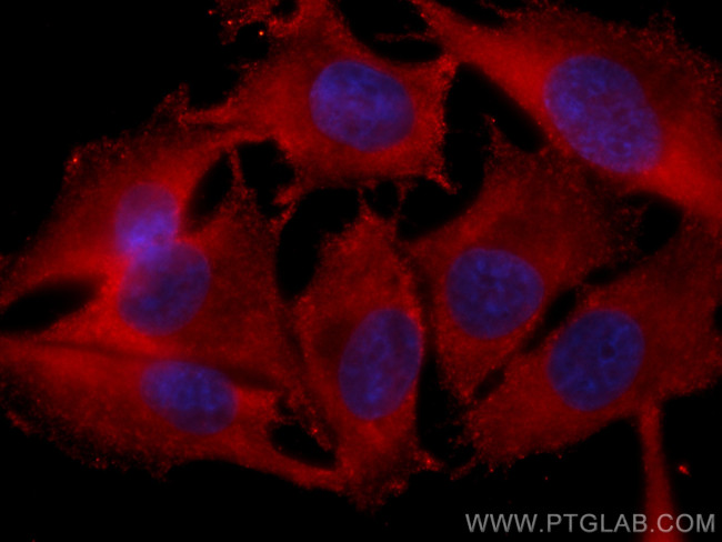 DLC1 Antibody in Immunocytochemistry (ICC/IF)