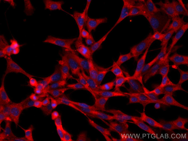 BLNK Antibody in Immunocytochemistry (ICC/IF)