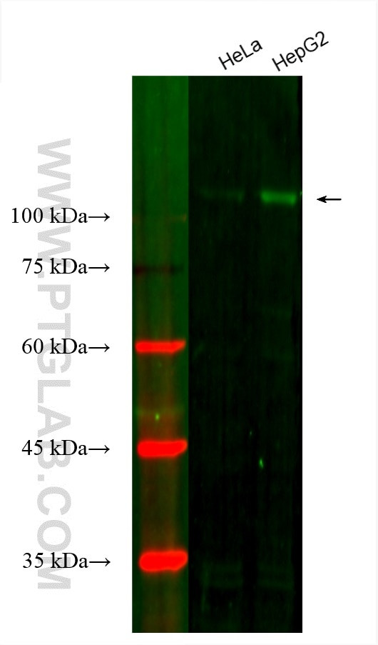 Hexokinase 2 Antibody in Western Blot (WB)