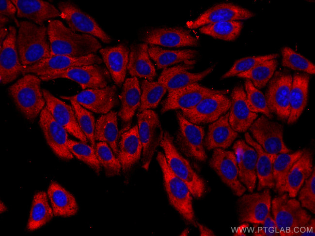 CAPN2 Antibody in Immunocytochemistry (ICC/IF)