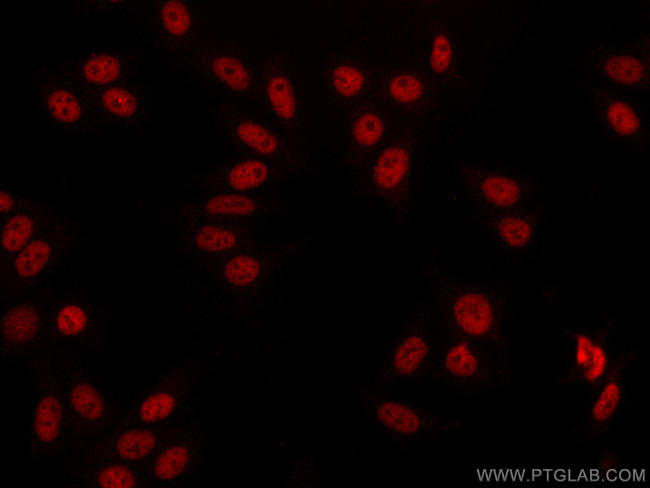 NBN Antibody in Immunocytochemistry (ICC/IF)