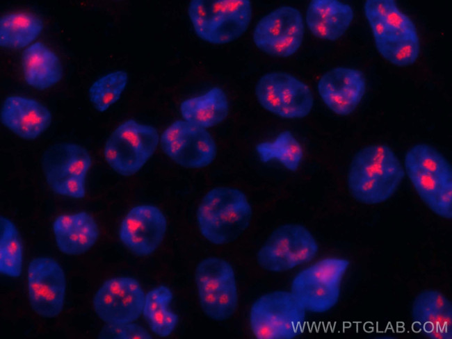 FBL Antibody in Immunocytochemistry (ICC/IF)