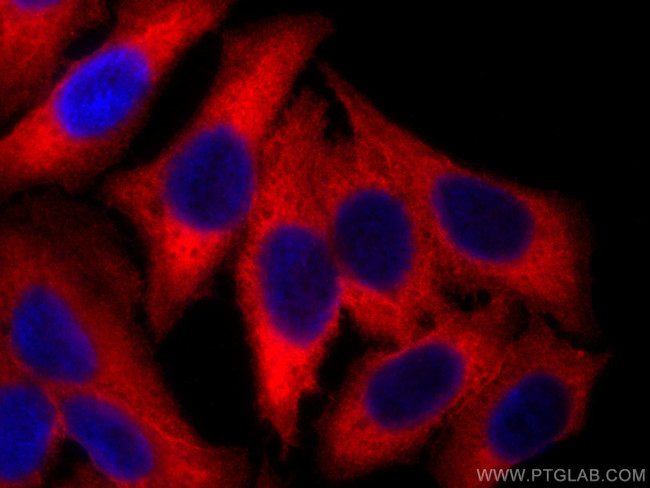 RRM2 Antibody in Immunocytochemistry (ICC/IF)