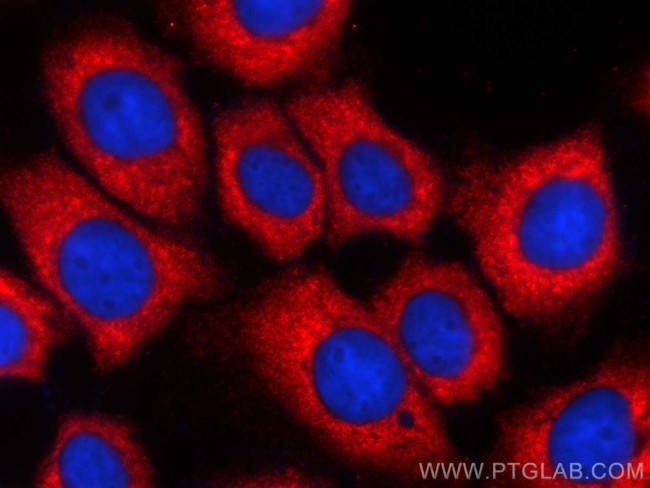 GNAI2 Antibody in Immunocytochemistry (ICC/IF)