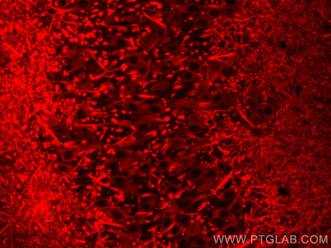 MAP2 Antibody in Immunohistochemistry (PFA fixed) (IHC (PFA))