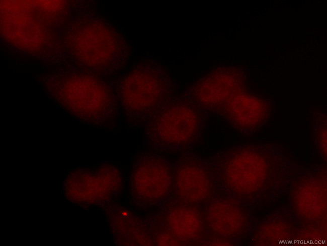 INTS3 Antibody in Immunocytochemistry (ICC/IF)